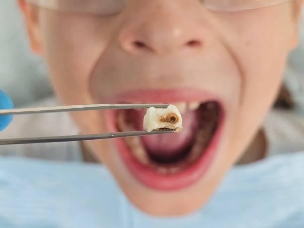 Best Same-Day Emergency Dentist in Osage City, KS