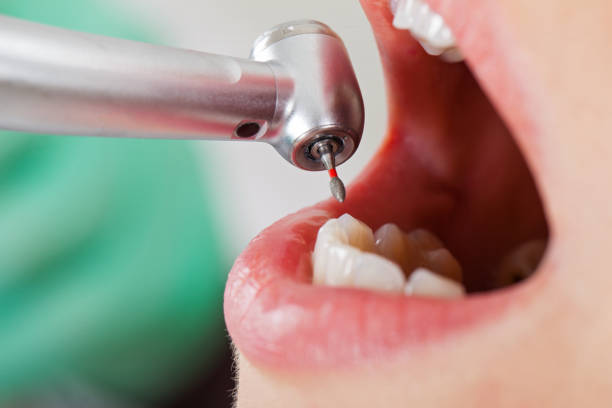 Best Weekend Emergency Dentist in Osage City, KS
